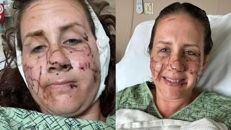 Mulher ficou gravemente ferida no rosto após ser atacada por lontra - Foto: Reprodução/Redes sociais